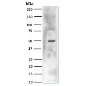 Western blot testing of human HEK293 cell lysate with CA9 antibody. Predicted molecular weight: 50-5