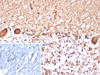 IHC staining of FFPE human brain tissue with S100B antibody (clone S100B/4148). Inset: PBS used in p