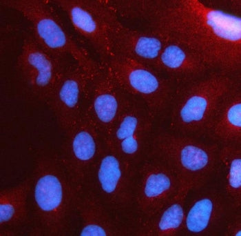 PSTPIP2 Antibody / Proline-serine-threonine phosphatase-interacting protein 2