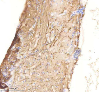 IHC staining of zebrafish Rab1aa/ab protein using Zebrafish Rab1a antibody, HRP-labeled secondary an