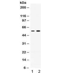 ACVR2B Antibody / ActRIIB
