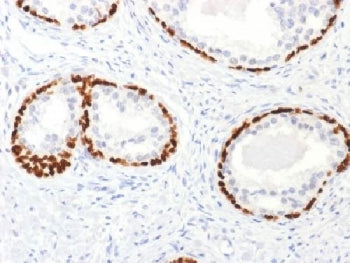 p63 Antibody / Tumor protein 63