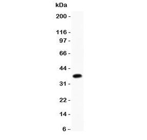 CD23 Antibody