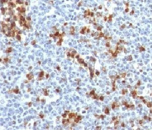 IHC testing of FFPE human tonsil and Kappa antibody (clone KC3L-1). Required HIER: boil tissue secti