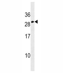 Erythropoietin antibody western blot analysis in CEM lysate. Predicted molecular weight: 18-34 kDa d