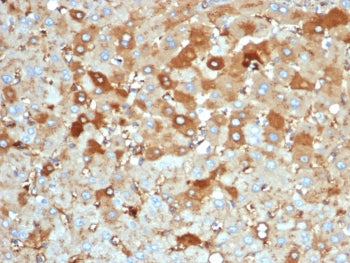 Albumin Antibody / ALB