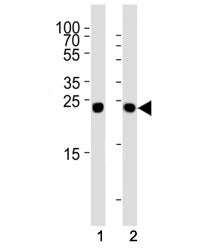 Western blot analysis of lysate from (1) HT29 and (2) HepG2 cell line using Glucagon antibody at 1:1