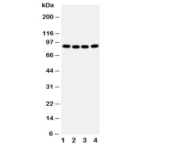 Western blot testing of CUL2 antibody and human samples 1: A431; 2: SMMC-7721; 3: HeLa; 4: COLO320 c