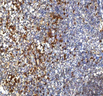 IHC staining of FFPE human tonsil tissue with PCPE1 antibody. HIER: boil tissue sections in pH8 EDTA