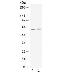 PAK3 Antibody