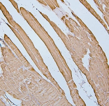 IHC staining of FFPE human skeletal muscle with Desmin antibody. HIER: boil tissue sections in pH6, 