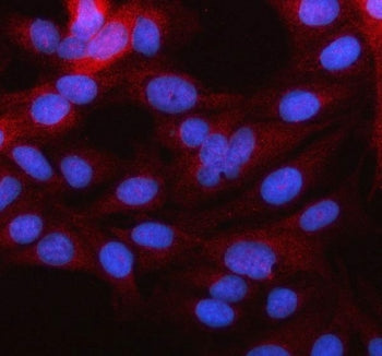 Immunofluorescent staining of FFPE human HeLa cells with MARCH2 antibody (red) and DAPI nuclear stai