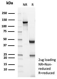 SDS-PAGE analysis of purified, BSA-free MSA antibody (clone MSA/8949R) as confirmation of integrity 