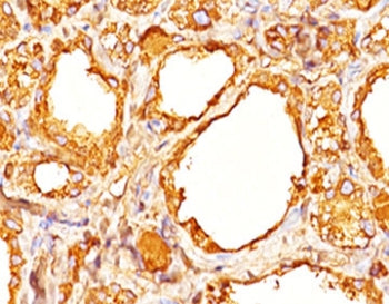 TG Antibody Cocktail / Thyroglobulin