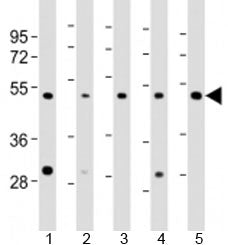 Western blot testing of human 1) HeLa, 2) HT-1080, 3) Jurkat, 4) LNCaP and 5) PC-3 cell lysate with 