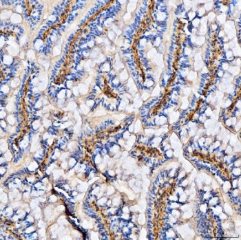 Col6a2 Antibody / Collagen VI