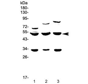 Western blot testing of 1) rat brain, 2) rat testis and 3) mouse testis lysate with GSK3 alpha antib