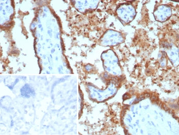 EBI3 Antibody / Epstein-Barr virus induced 3
