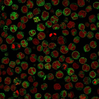 CD79a Antibody
