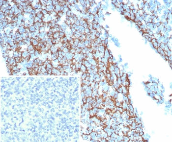 IHC staining of FFPE human tonsil tissue with CD35 antibody (clone CR1/8244R). Inset: PBS used in pl