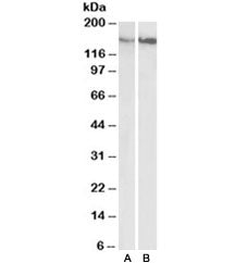 Western blot testing of gastrointestinal cancer [A] and gall bladder cancer [B] lysates with CD29 an