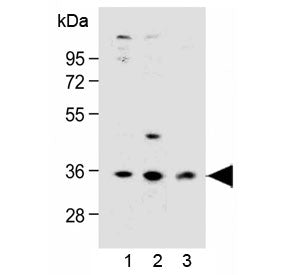 Western blot testing of human 1) LNCaP, 2) PC-3 and 3) HEK293 cell lysate with OR6C3 antibody at 1:1