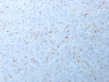 IHC testing of FFPE human spleen with recombinant MMP3 antibody (clone MMP3/1994R). Required HIER: b