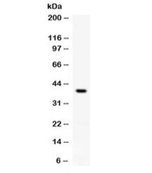 RANKL Antibody