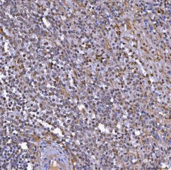 TOP3B Antibody / DNA topoisomerase 3-beta-1