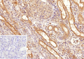 IHC staining of FFPE human kidney tissue with Fms-like tyrosine kinase 3 antibody (clone FLT3/9886).