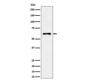 Western blot testing of human 293T cell lysate with EYA2 antibody. Predicted molecular weight ~59 kD