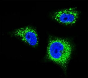 Confocal immunofluorescent analysis of TrkA antibody with MDA-MB231 cells followed by Alexa Fluor 48