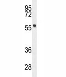 FEZF1 antibody western blot analysis in mouse stomach tissue lysate. Predicted molecular weight ~ 52