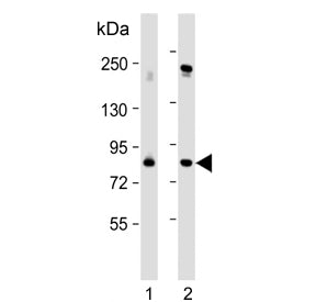Western blot testing of human 1) 293T/17 and 2) HeLa cell lysate with Polo-like kinase 2 antibody. P