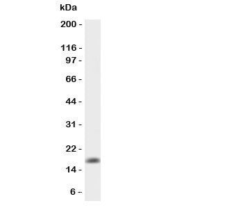 GMCSF Antibody