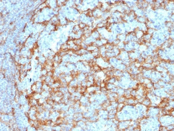 IHC testing of FFPE human lymph node with CD14 antibody (clone LPSR/2385). HIER: boil tissue section