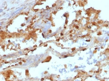 KRT8 Antibody / Cytokeratin 8