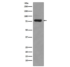 Western blot testing of human 22RV1 lysate with AR-V7 antibody. Predicted molecular weight ~68 kDa b