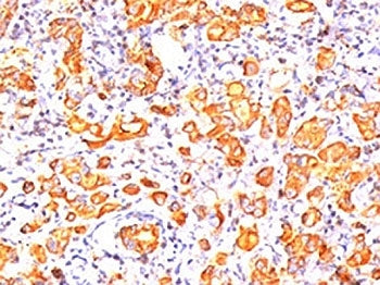 MUC1 Antibody / Mucin-1