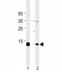 Myoglobin antibody western blot analysis in mouse 1) heart and 2) skeletal muscle tissue lysate. Pre