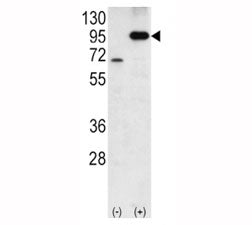 Western blot analysis of Amyloid beta antibody and 293 cell lysate either nontransfected (Lane 1) or