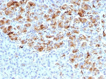 Alpha-1-Antichymotrypsin Antibody / AACT / SERPINA3