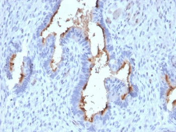 IHC testing of FFPE human endometrium with Podocalyxin antibody (clone PODXL/2185). HIER: boil tissu
