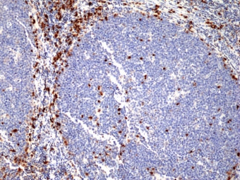 Recombinant IRF4 Antibody / Interferon regulatory factor 4