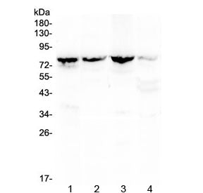 Western blot testing of 1) rat kidney, 2) mouse kidney, 3) mouse lung and 4) human MCF7 lysate with 