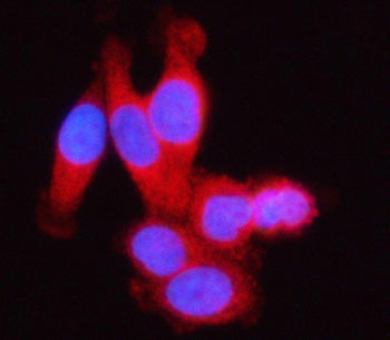 Immunofluorescent staining of SSSCA1/ZNRD2 using anti-ZNRD2 antibody (red). ZNRD2 was detected in an