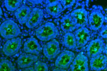 Immunofluorescent staining of FFPE rat stomach tissue with Tspan1 antibody (green) and DAPI nuclear 