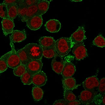Immunofluorescent staining of FFPE human HepG2 cells with anti-TNF-alpha antibody (green) and RedDot