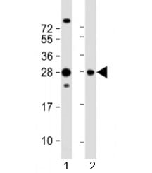 Western blot testing of 1) human HepG2 and 2) rat PC-12 cell lysate with PIMT antibody at 1:2000. Pr