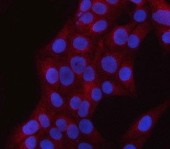 PNPLA6 Antibody / Patatin-like phospholipase domain-containing protein 6 / NTE
